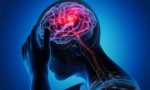 Las consecuencias de un infarto cerebral pueden ser muy variadas, pues dependen de la región del cerebro donde este se haya producido